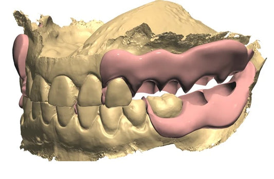 Partial Removable Prosthodontics